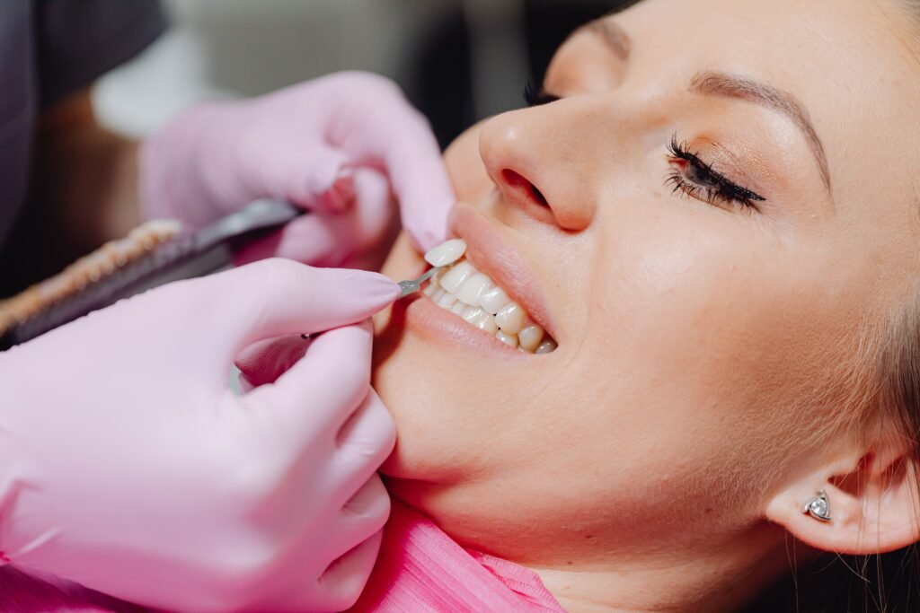 Dentist matching a veneer shade guide to a smiling patient’s teeth